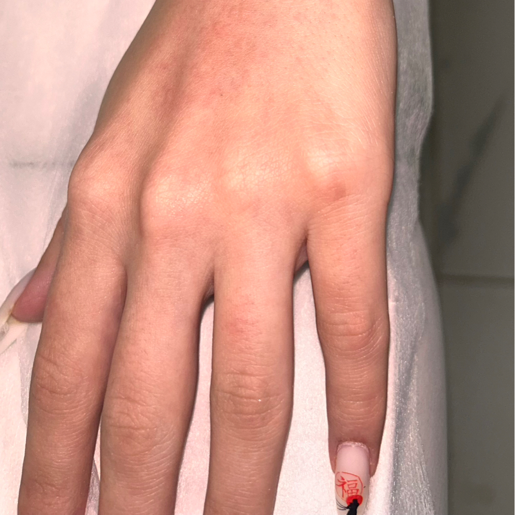 Пальцы рук/ног