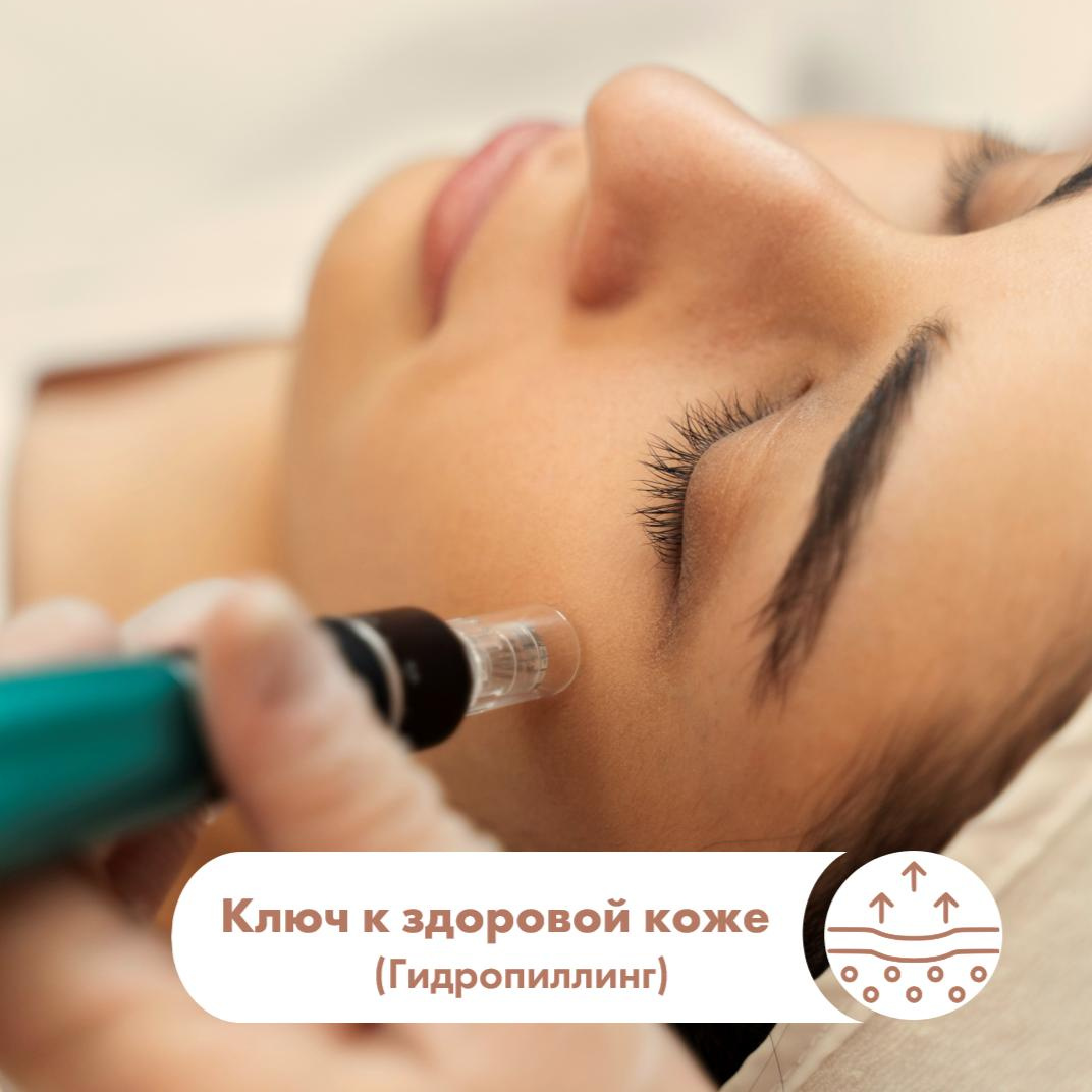Ключ к здоровой коже (Гидропиллинг)