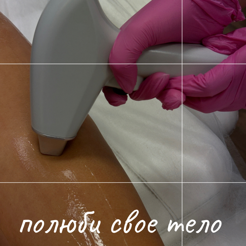 Аппаратное удаление волос