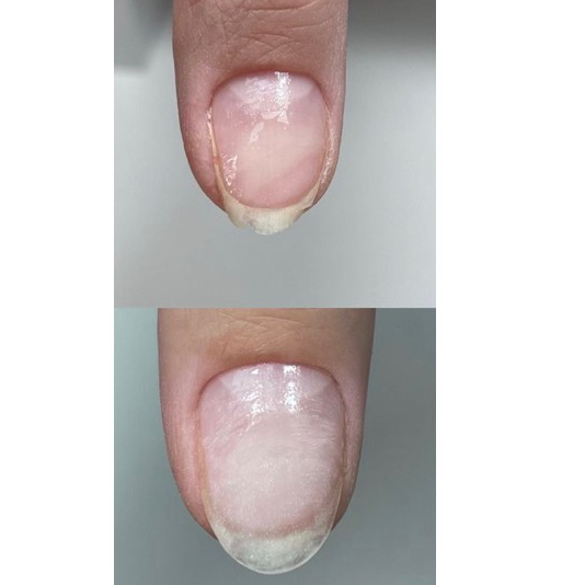 Ремонт 1-ого ногтя