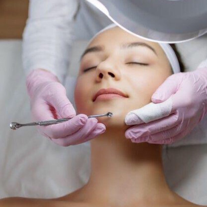 Механическая чистка лица