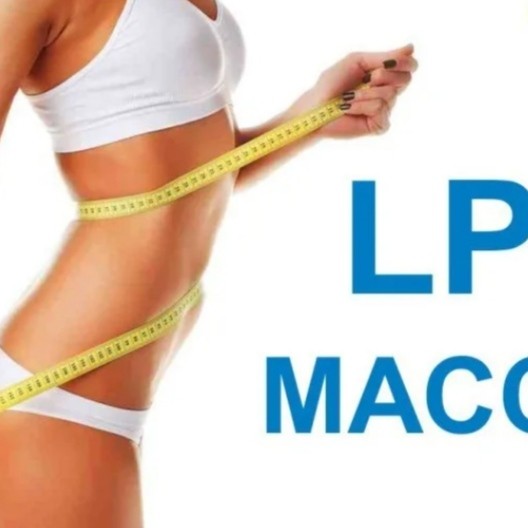 LPG массаж  тела(40 минут)