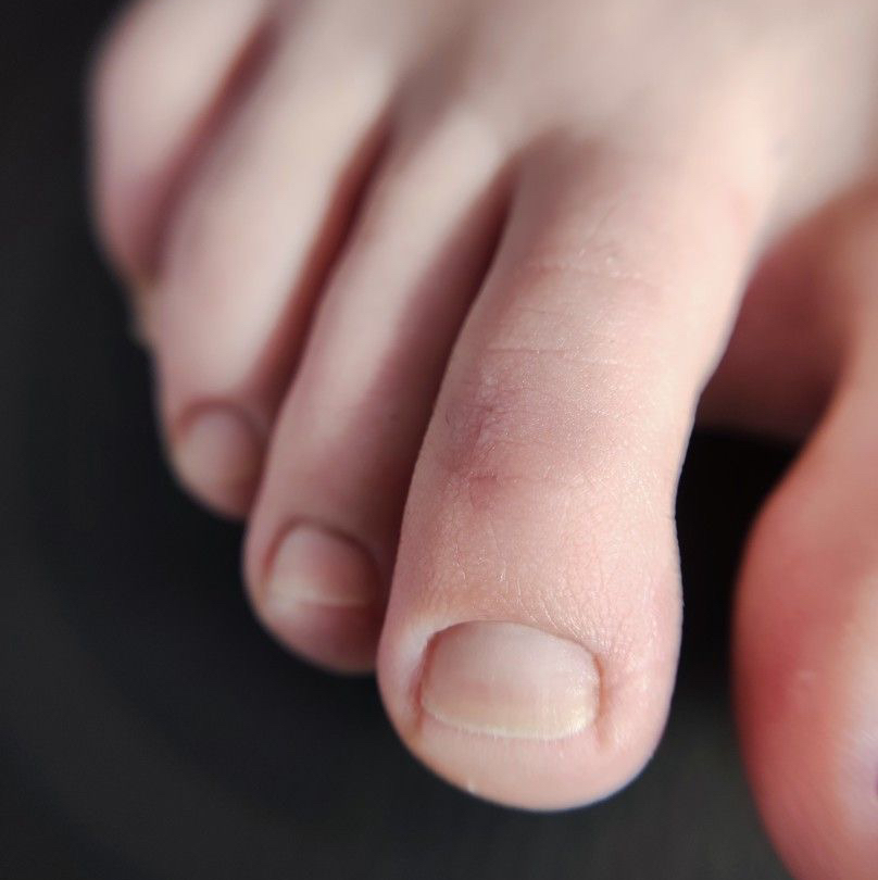 Педикюр пальчики