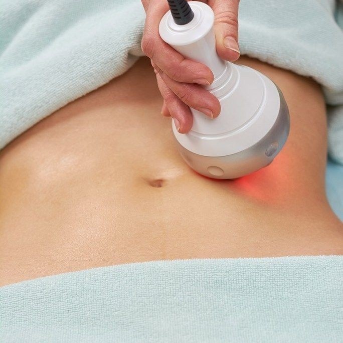 RF лифтинг живота