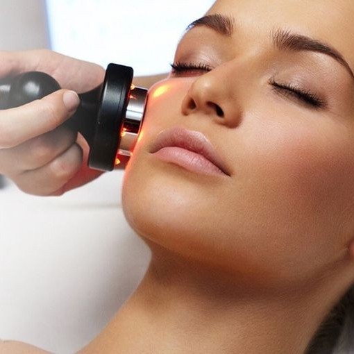 RF лифтинг лица