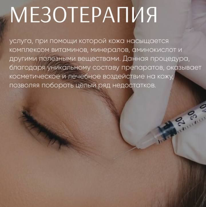 Мезотерапия