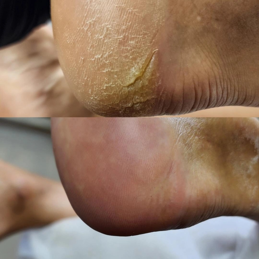 SMARTICURE (полная обработка стопы смартикюр без покрытия)