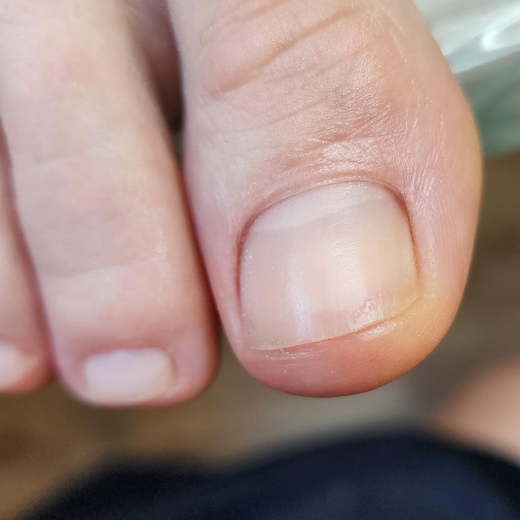 Smart izi (обработка пальчиков смарт изи)