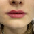 Введение гиалуронового геля Belotero lips shape( легкий обьем)0,6мл