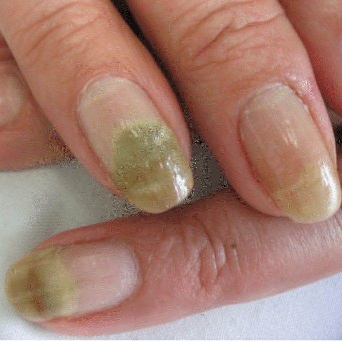 Подологический маникюр