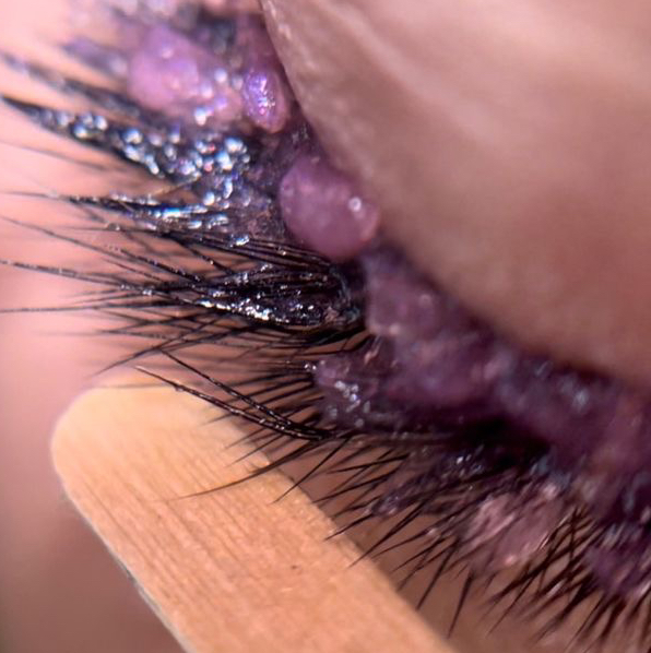 Снятие ресниц