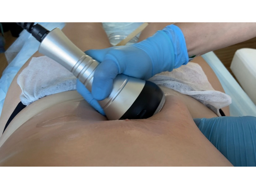 Кавитация+Lpg массаж 10 процедур