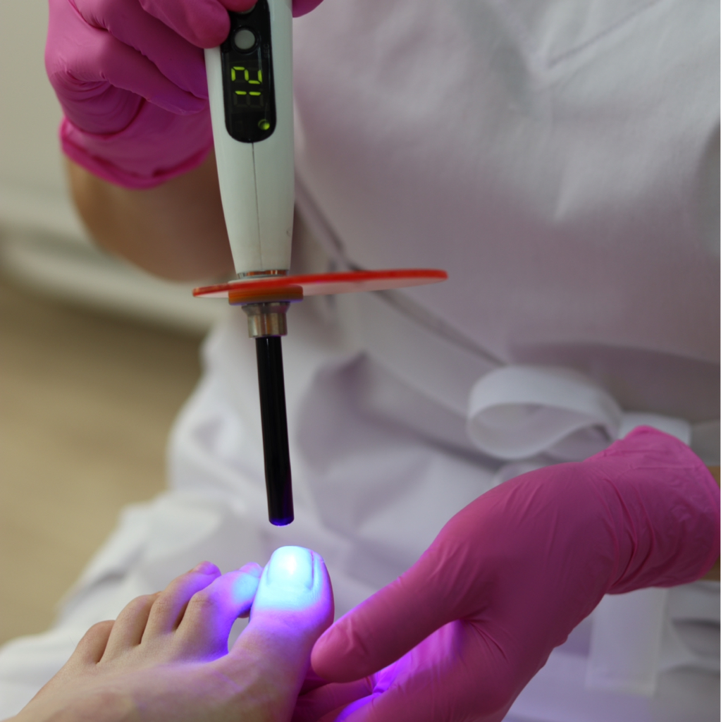 Коррекция титановой нити большой палец