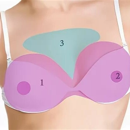 Грудь ореолы