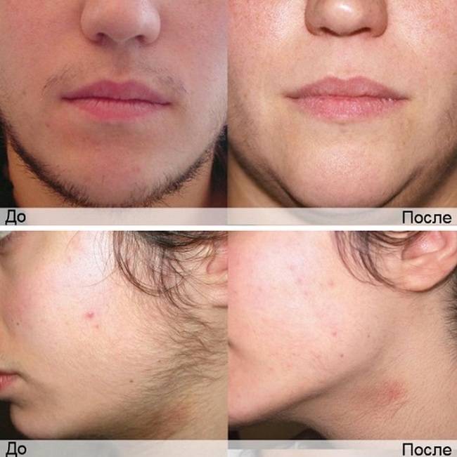 Бакенбарды,щеки,лоб