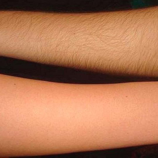 Руки ниже локтя