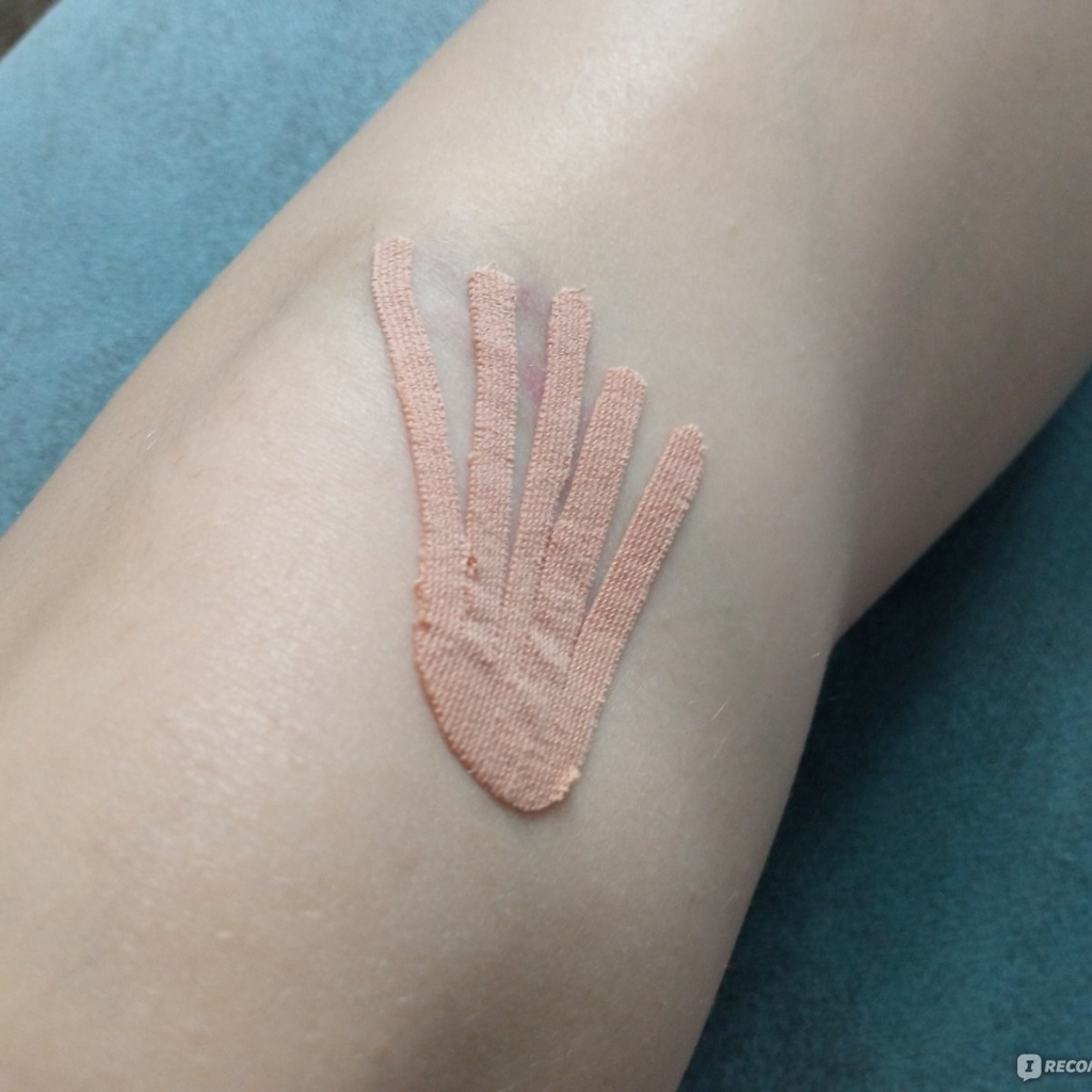 Тейпирование гематомы/ шрама